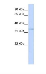 Jurkat cell lysate. Antibody concentration: 1.0 ug/ml. Gel concentration: 12%.