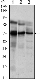 Western blot using ETV5 mouse monoclonal antibody against Jurkat (1), NIH/3T3 (2) and MCF-7 (3) cell lysate.