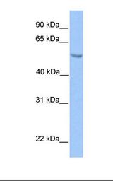 Transfected 293T cell lysate. Antibody concentration: 1.0 ug/ml. Gel concentration: 12%.
