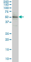 ETV5 monoclonal antibody (M01), clone 3B10 Western Blot analysis of ETV5 expression in HeLa NE.