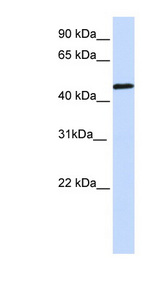 ETV6 antibody LS-B6970 Western blot of 721_B cell lysate.