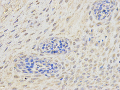 Immunohistochemistry of paraffin-embedded human esophagus using ETV6 antibody at dilution of 1:200 (400x lens).