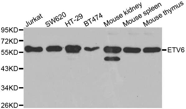 Western blot analysis of extracts of various cell lines, using ETV6 antibody.