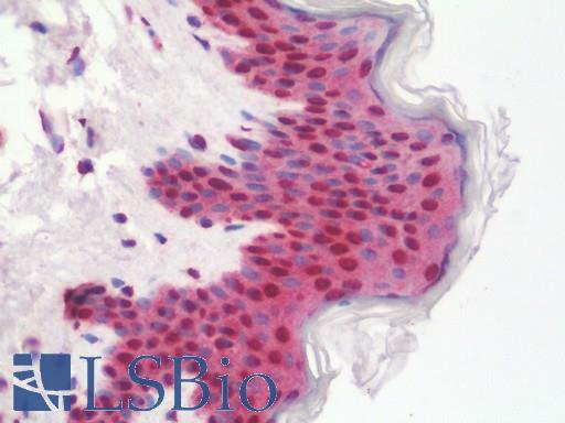 Anti-ETV6 / TEL antibody IHC staining of human skin. Immunohistochemistry of formalin-fixed, paraffin-embedded tissue after heat-induced antigen retrieval. Antibody LS-B10433 dilution 1:100.