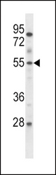 ETV6 Antibody western blot of mouse lung tissue lysates (35 ug/lane). The ETV6 antibody detected the ETV6 protein (arrow).