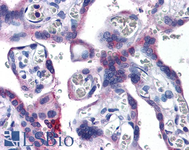 Anti-EVC2 antibody IHC of human placenta. Immunohistochemistry of formalin-fixed, paraffin-embedded tissue after heat-induced antigen retrieval. Antibody LS-B4966 concentration 3.75 ug/ml.