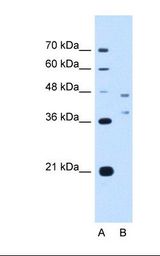 Lane A: Marker. Lane B: HepG2 cell lysate. Antibody concentration: 2.5 ug/ml. Gel concentration: 12%.