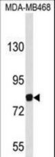 Western blot of EVI5 Antibody in MDA-MB468 cell line lysates (35 ug/lane). EVI5 (arrow) was detected using the purified antibody.
