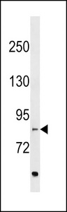 EVI5L Antibody western blot of MDA-MB453 cell line lysates (35 ug/lane). The EVI5L antibody detected the EVI5L protein (arrow).