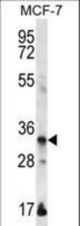 EVPLL Antibody western blot of MCF-7 cell line lysates (35 ug/lane). The EVPLL antibody detected the EVPLL protein (arrow).