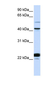 EVX1 antibody LS-C112134 Western blot of HeLa lysate.