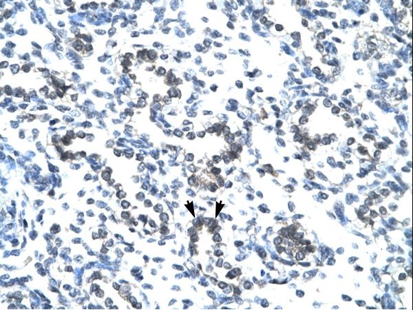 EVX1 antibody LS-C30973 was used in IHC to stain formalin-fixed, paraffin-embedded human lung.
