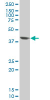 EVX1 monoclonal antibody (M04), clone 3F4 Western Blot analysis of EVX1 expression in HeLa.