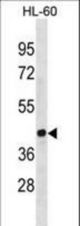 EVX1 Antibody western blot of HL-60 cell line lysates (35 ug/lane). The EVX1 antibody detected the EVX1 protein (arrow).