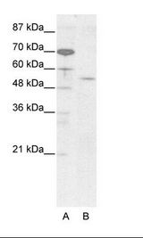 A: Marker, B: HepG2 Cell Lysate