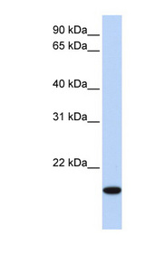 EVX2 antibody LS-C112186 Western blot of HeLa lysate.