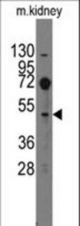 Western blot of anti-Evx2 antibody in mouse kidney tissue lysates (35 ug/lane). Evx2(arrow) was detected using the purified antibody.
