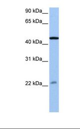 Jurkat cell lysate. Antibody concentration: 0.5 ug/ml. Gel concentration: 12%.