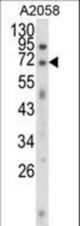 Western blot of EWSR1 Antibody in A2058 cell line lysates (35 ug/lane). EWSR1 (arrow) was detected using the purified antibody.