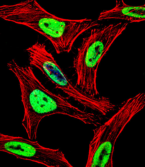 Fluorescent confocal image of HeLa cell stained with EWSR1 Antibody. HeLa cells were fixed with 4% PFA (20 min), permeabilized with Triton X-100 (0.1%, 10 min), then incubated with EWSR1 primary antibody (1:25, 1 h at 37°C). For secondary antibody, Alexa Fluor 488 conjugated donkey anti-rabbit antibody (green) was used (1:400, 50 min at 37°C). Cytoplasmic actin was counterstained with Alexa Fluor 555 (red) conjugated Phalloidin (7units/ml, 1 h at 37°C). Nuclei were counterstained with DAPI (blue) (10 ug/ml, 10 min). EWSR1 immunoreactivity is localized to Nucleus significantly.