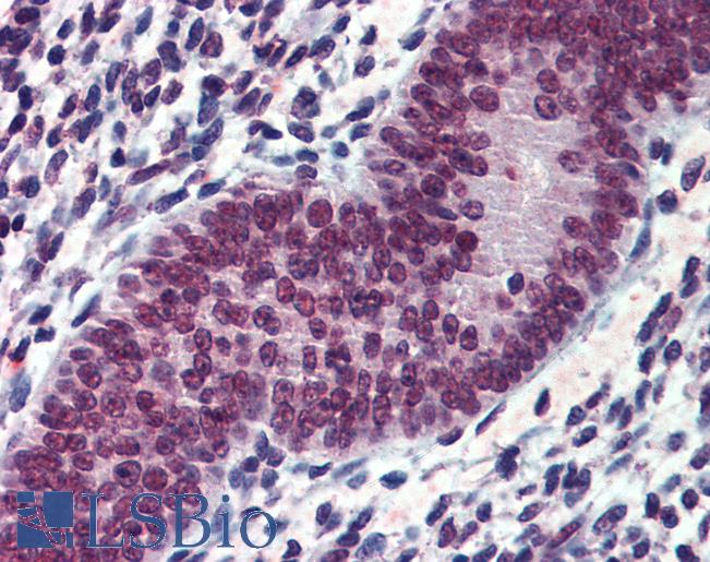 Anti-EWSR1 antibody IHC of human uterus. Immunohistochemistry of formalin-fixed, paraffin-embedded tissue after heat-induced antigen retrieval. Antibody LS-B3967 concentration 3.75 ug/ml.