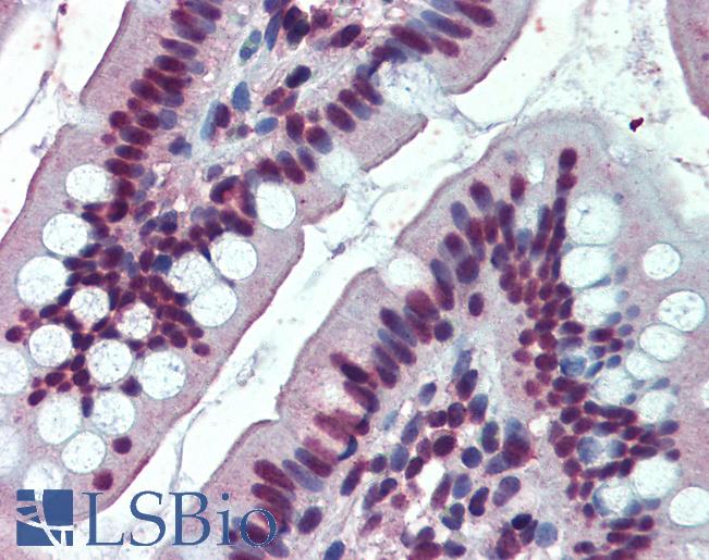 Anti-EWSR1 antibody IHC of human small intestine. Immunohistochemistry of formalin-fixed, paraffin-embedded tissue after heat-induced antigen retrieval. Antibody LS-B3967 concentration 3.75 ug/ml.