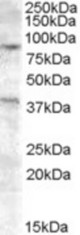 Antibody (0.2 ug/ml) staining of A549 cell lysate (35 ug protein in RIPA buffer). Primary incubation was 1 hour. Detected by chemiluminescence.