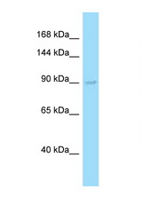 EXO1 antibody LS-C146178 Western blot of Fetal Liver lysate. Antibody concentration 1 ug/ml.