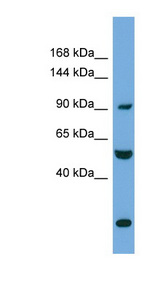 EXOC1 antibody LS-C117276 Western blot of HeLa lysate.
