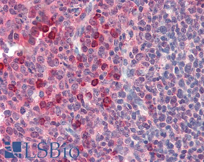 Anti-EXOC3 antibody IHC of human tonsil. Immunohistochemistry of formalin-fixed, paraffin-embedded tissue after heat-induced antigen retrieval. Antibody LS-B2988 concentration 10 ug/ml.