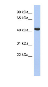 EXOC4 / SEC8 antibody LS-C111859 Western blot of Jurkat lysate.