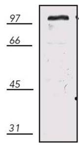 Western analysis of rat brain tissue extract.
