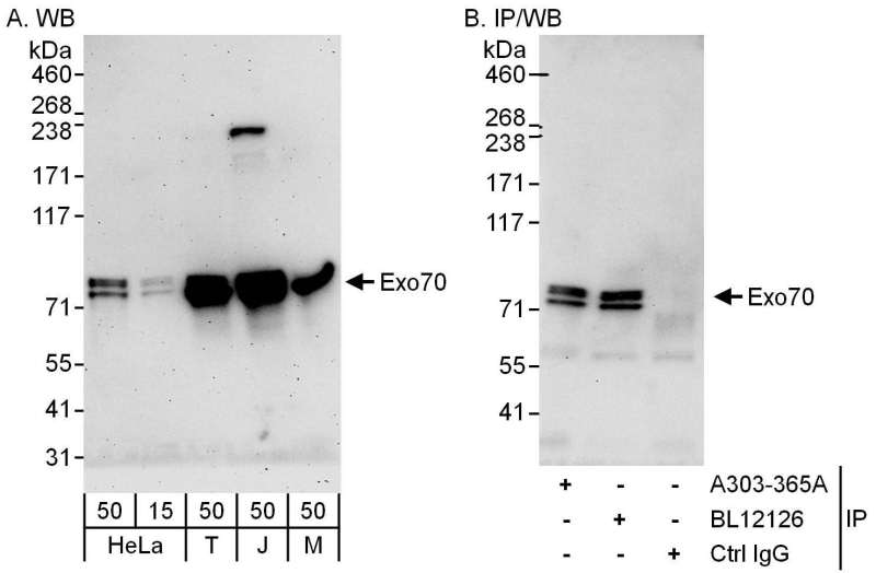 Detection of Human and Mouse Exo70 by Western Blot (h and m) and Immunoprecipitation (h). Samples: Whole cell lysate from HeLa (15 and 50 ug for WB; 1 mg for IP, 20% of IP loaded), 293T (T; 50 ug), Jurkat (J; 50 ug) and mouse NIH3T3 (M; 50 ug) cells. Antibodies: Affinity purified rabbit anti-Exo70 antibody used for WB at 0.1 ug/ml (A) and 1 ug/ml (B) and used for IP at 6 ug/mg lysate. Exo70 was also immunoprecipitated by rabbit anti-Exo70 antibody BL12126, which recognizes a downstream epitope. Detection: Chemiluminescence with exposure times of 3 minutes (A) and 30 seconds (B).