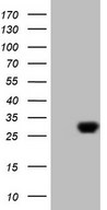 HEK293T cells were transfected with the pCMV6-ENTRY control (Left lane) or pCMV6-ENTRY EXOSC1 (Right lane) cDNA for 48 hrs and lysed. Equivalent amounts of cell lysates (5 ug per lane) were separated by SDS-PAGE and immunoblotted with anti-EXOSC1 (1:2000).