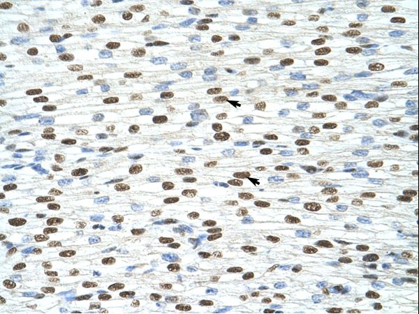 EXOSC4 antibody LS-C30654 was used in IHC to stain formalin-fixed, paraffin-embedded human heart.