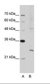 A: Marker, B: Jurkat Cell Lysate