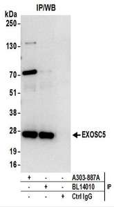 Detection of Human EXOSC5 by Western Blot of Immunoprecipitates. Samples: Whole cell lysate (1 mg for IP; 20% of IP loaded) from 293T cells. Antibodies: Affinity purified rabbit anti-EXOSC5 antibody used for IP at 6 ug/mg lysate. EXOSC5 was also immunoprecipitated by rabbit anti-EXOSC5 antibody BL14010. For blotting immunoprecipitated EXOSC5, was used at 1 ug/ml. Detection: Chemiluminescence with an exposure time of 10 seconds.
