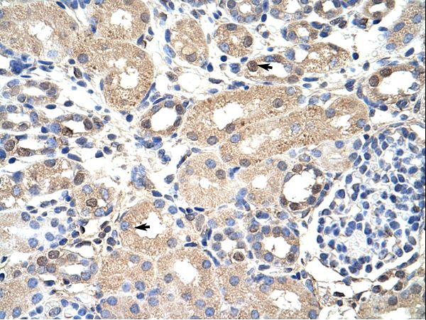 EXOSC7 antibody LS-C30706 was used in IHC to stain formalin-fixed, paraffin-embedded human kidney.