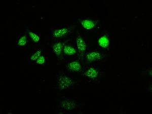 Immunofluorescent staining of HeLa cells using anti-EXOSC7 antibody.