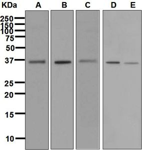 Western blot analysis on (A) NCI-H460, (B) A431, (C) HeLa, (D) Caco-2, and (E) Molt-4 cell lysates using anti-EXOSC7 antibody.