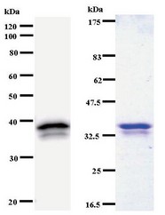 Western blot of immunized recombinant protein using EXOSC7 antibody. Left: EXSOC7 staining. Right: Coomassie Blue staining of immunized recombinant protein.
