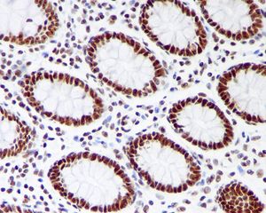 IHC of paraffin-embedded human colon tissue using anti-EXOSC7 antibody.