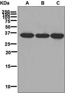Western blot analysis on (A) K562, (B) Jurkat, and (C) NCI-H460 cell lysates using anti-EXOSC7 antibody.