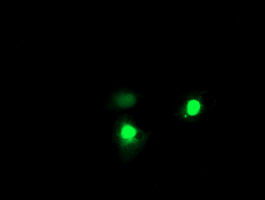 Anti-EXOSC7 mouse monoclonal antibody immunofluorescent staining of COS7 cells transiently transfected by pCMV6-ENTRY EXOSC7.
