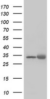 HEK293T cells were transfected with the pCMV6-ENTRY control (Left lane) or pCMV6-ENTRY EXOSC7 (Right lane) cDNA for 48 hrs and lysed. Equivalent amounts of cell lysates (5 ug per lane) were separated by SDS-PAGE and immunoblotted with anti-EXOSC7.