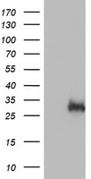 HEK293T cells were transfected with the pCMV6-ENTRY control (Left lane) or pCMV6-ENTRY EXOSC7 (Right lane) cDNA for 48 hrs and lysed. Equivalent amounts of cell lysates (5 ug per lane) were separated by SDS-PAGE and immunoblotted with anti-EXOSC7.