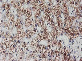 IHC of paraffin-embedded Human liver tissue using anti-EXOSC7 mouse monoclonal antibody.