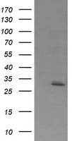 HEK293T cells were transfected with the pCMV6-ENTRY control (Left lane) or pCMV6-ENTRY EXOSC7 (Right lane) cDNA for 48 hrs and lysed. Equivalent amounts of cell lysates (5 ug per lane) were separated by SDS-PAGE and immunoblotted with anti-EXOSC7.