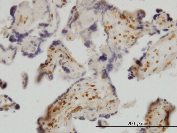 Immunoperoxidase of monoclonal antibody to EXOSC8 on formalin-fixed paraffin-embedded human placenta. [antibody concentration 3 ug/ml]