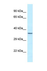 EXOSC9 antibody LS-C145727 Western blot of Fetal Heart lysate. Antibody concentration 1 ug/ml.